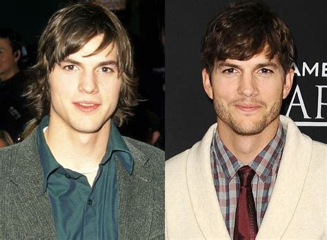 ashton kutcher chin implant