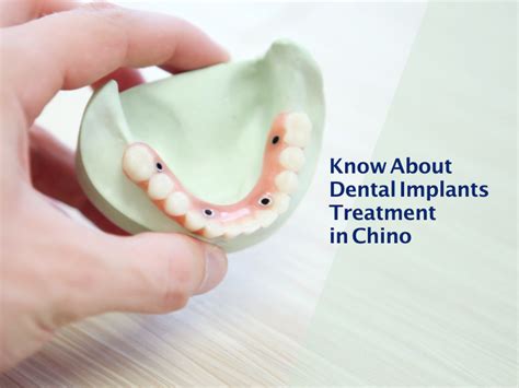 implant dentist chino
