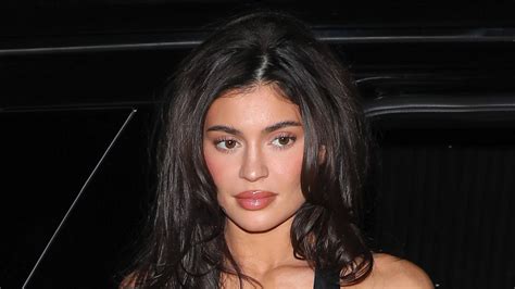 kylie chin implant