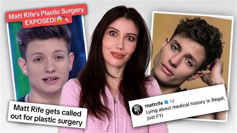matt rife chin implant