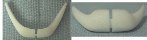 medpor chin implant