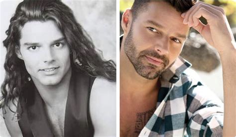 ricky martin chin implant